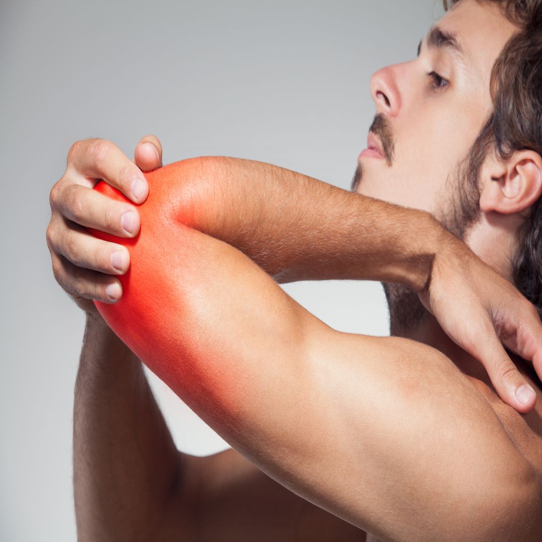 What Is Cubital Tunnel Syndrome? - Mirza Orthopedics