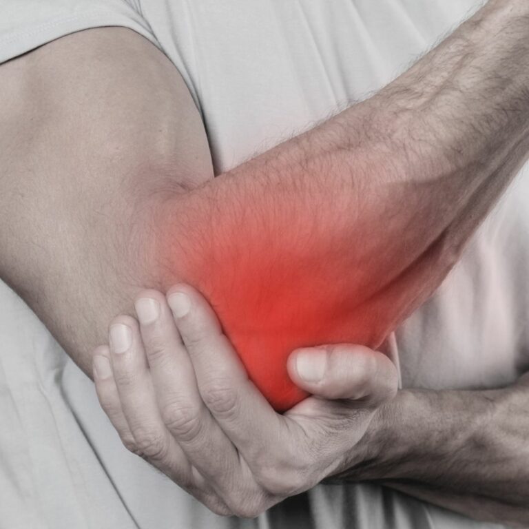 Orthopedic doctors Smithtown NY Cubital Tunnel Syndrome